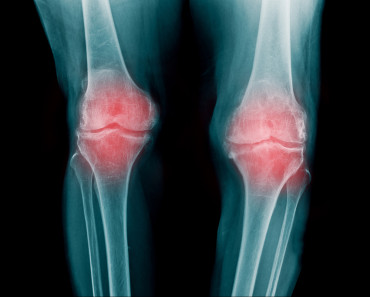 Bones shutterstock_522406408
