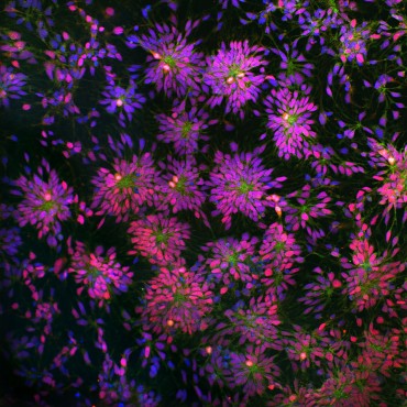 Neural stem cells